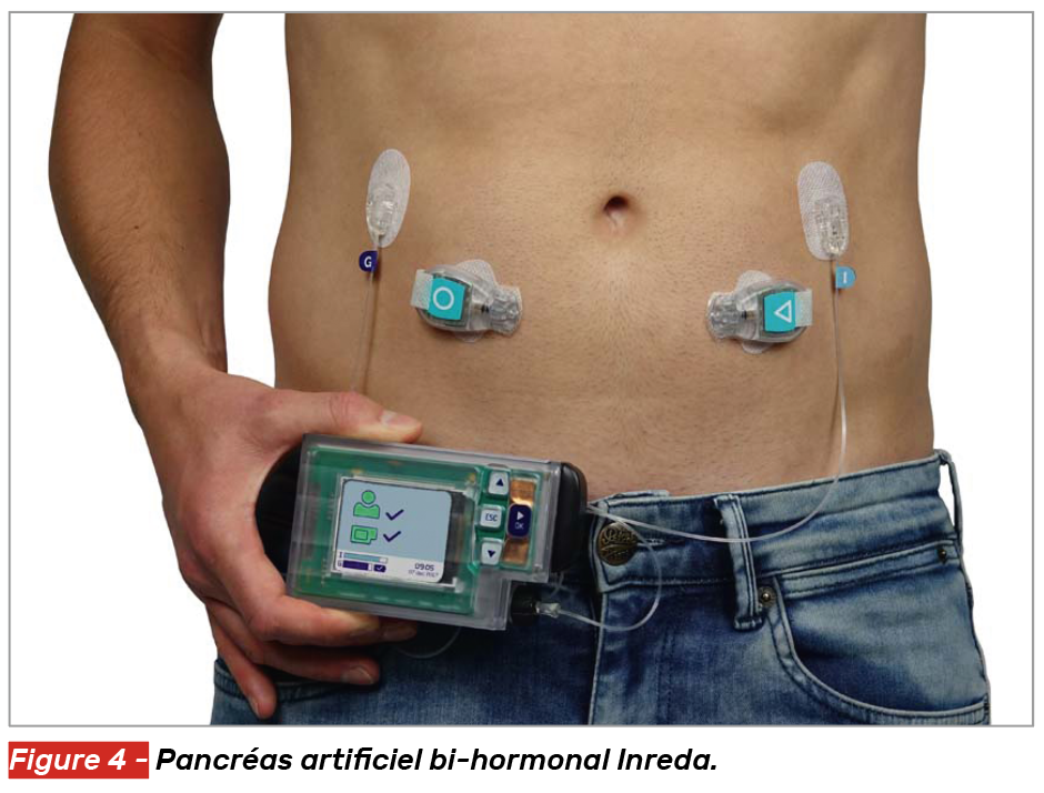 Insulinothérapie automatisée